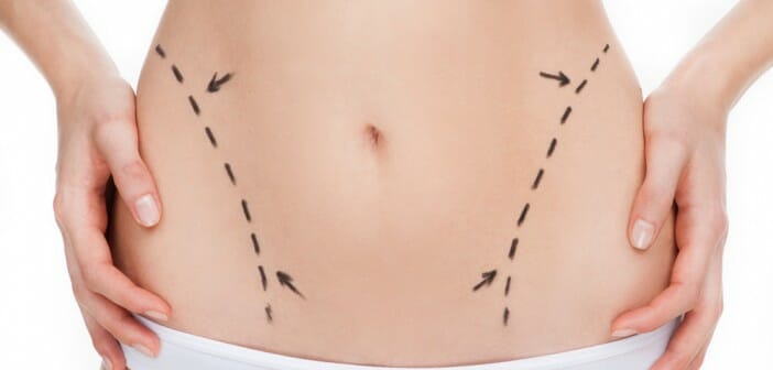 La chirurgie esthétique pour maigrir