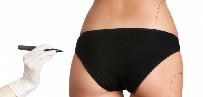 La liposuccion fait-elle perdre du poids ?