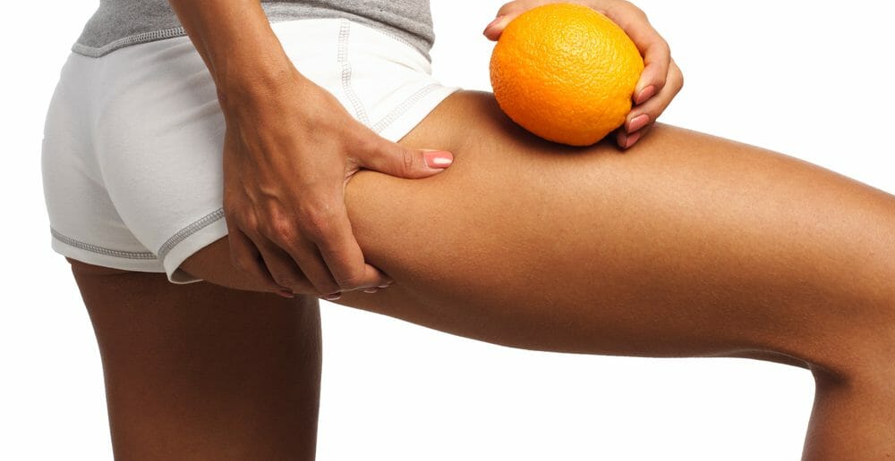 Cellulite : le régime anti rétention d'eau qui marche