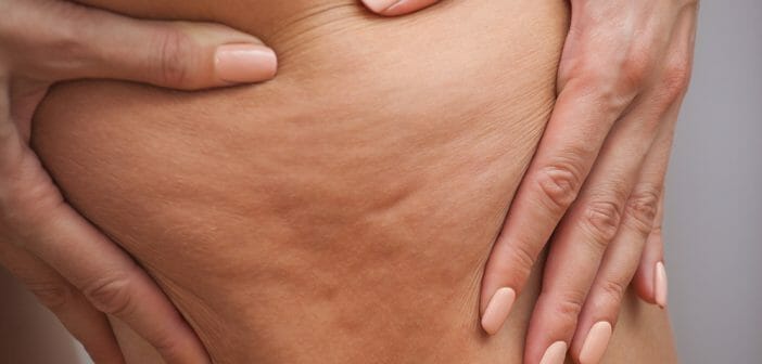 Le drainage lymphatique pour lutter contre la cellulite
