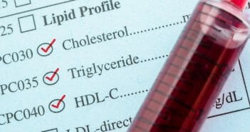 Triglycérides élevés : 4 méthodes pour faire baisser un taux excessif