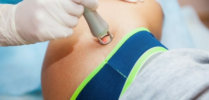 Perdre des hanches grâce au laser