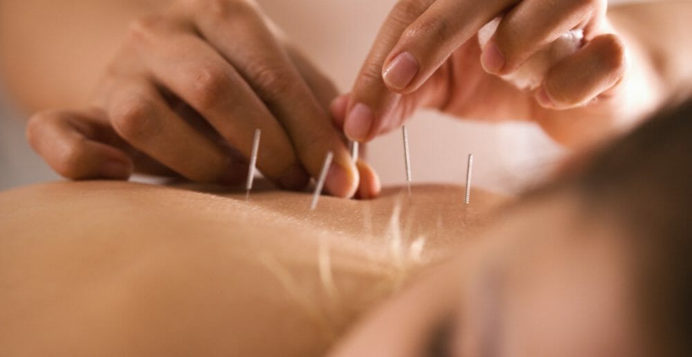 acumpuncture-efficace-pour-regler-la-thyroide