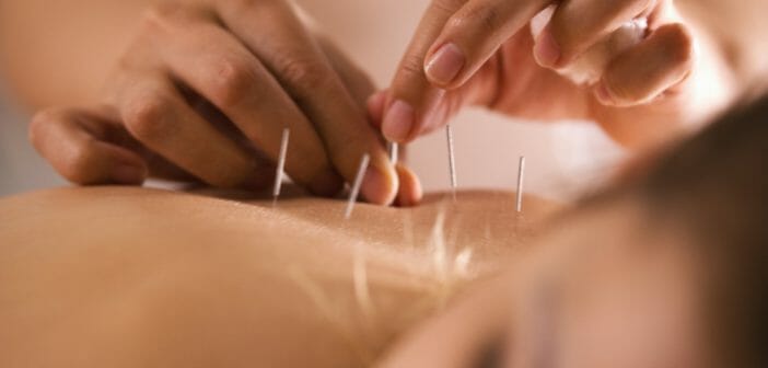 acumpuncture-efficace-pour-regler-la-thyroide